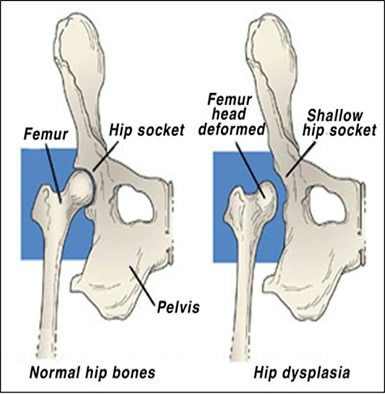 Canine Hip Dysplasia